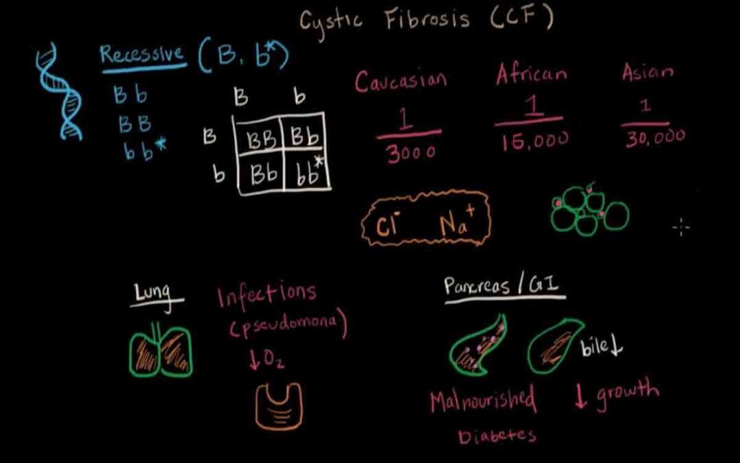 Cystic Fibrosis Therapy Improved by Lipid-Based Nanoparticles