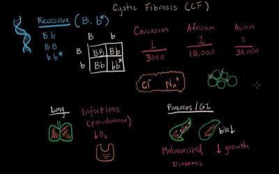 Cystic Fibrosis Therapy Improved by Lipid-Based Nanoparticles