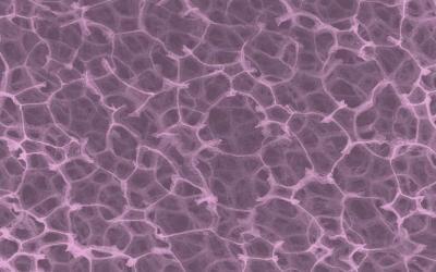 Osteoarthritis Pain Eased by Graphene Foam Suggested by Research