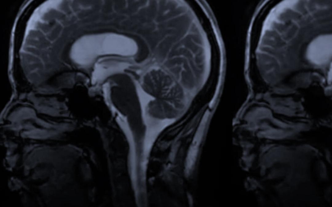 The beating brain: A video captures the organ’s rhythmic pulsations