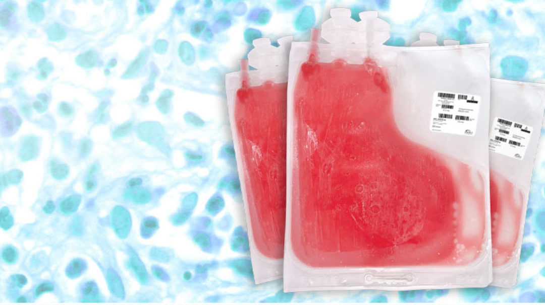 AllCells Announces First to Market Launch of In Stock GMP-Compliant Cryopreserved Leukopaks